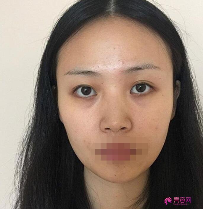 做双眼皮整容手术医院都有哪家？上海九院、北京八大处等，资料信息