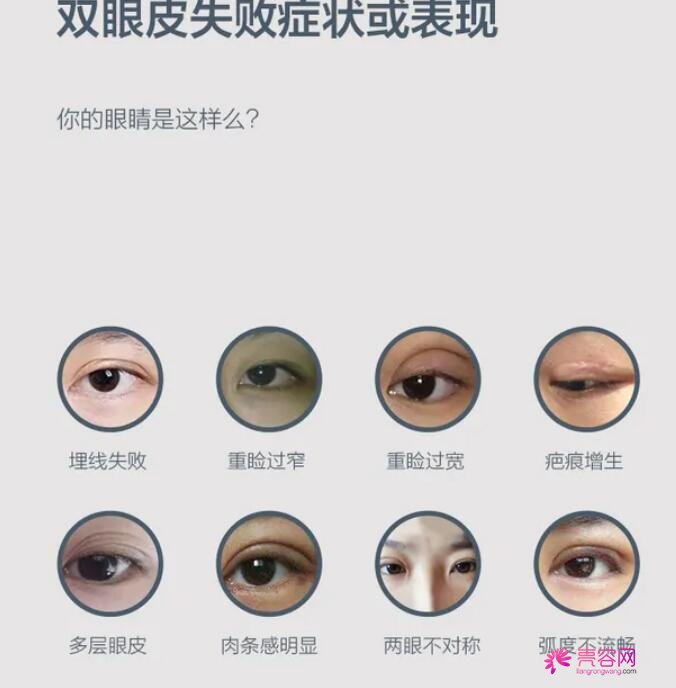 上海长海医院杨超究竟怎么样？医生信息|双眼皮修复案例术后真实反馈