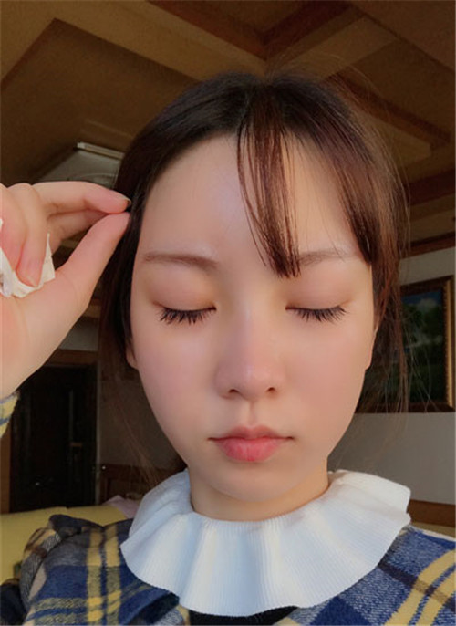 上海华美李健自体脂肪填充怎么样？案例_价格_口碑